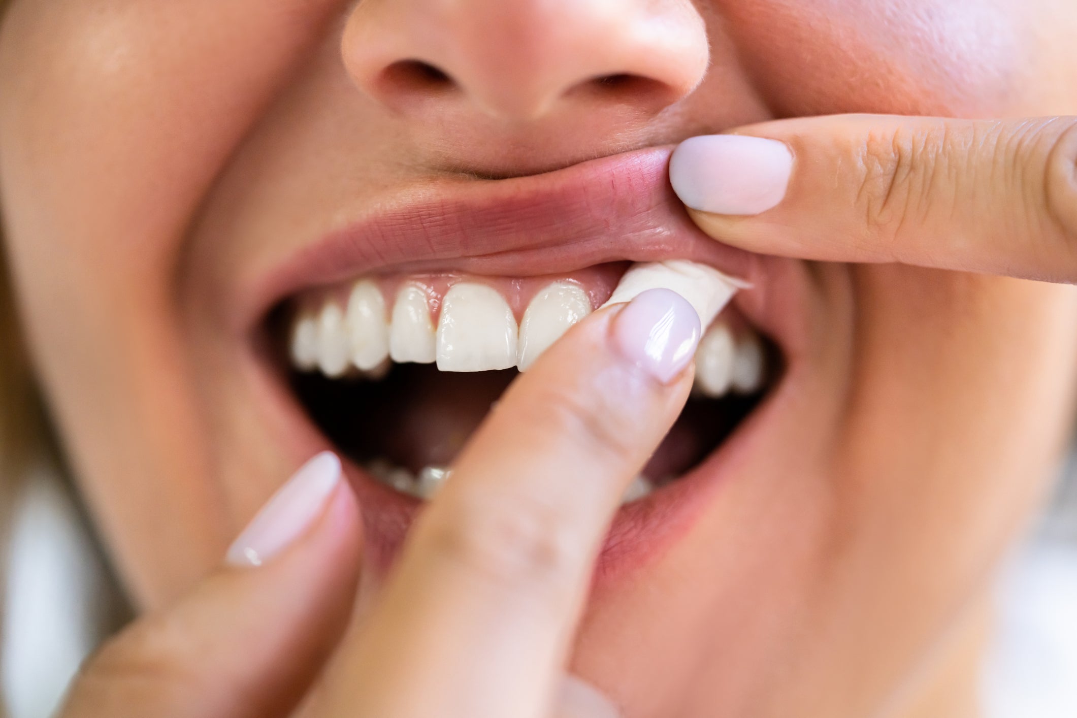 Conservative health spokesman Dr Sandesh Gulhane said he is unclear on whether products like snus are part of the ban